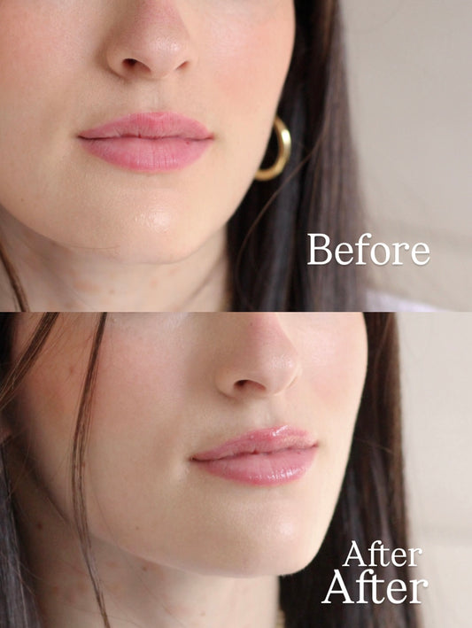 Ultra Hydrating Lip Balm (Medium)